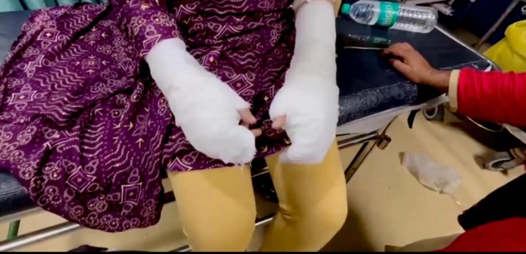 5 shocking revelations in Delhi acid attack: ‘It wasn’t’ | What police said about DU student case